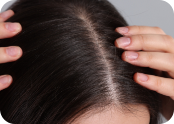 Scalp Care Matters